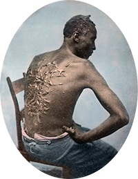 Picture of slave named Gordon with back covered with scars
